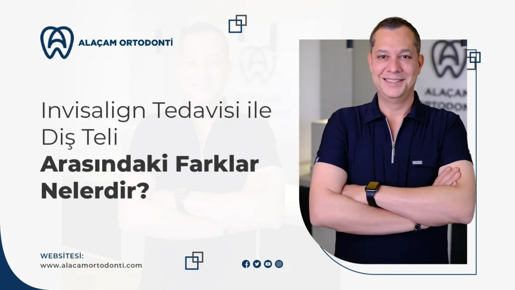 Şeffaf Plak Tedavisi ile Diş Teli Arasındaki Farklar Nelerdir?